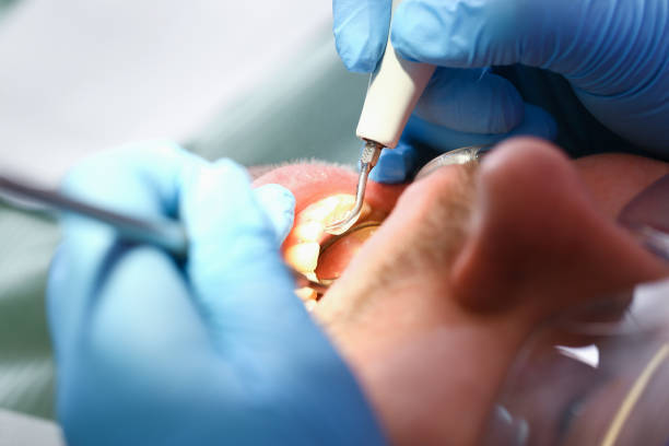 Best Emergency TMJ Treatment in Mikes, TX